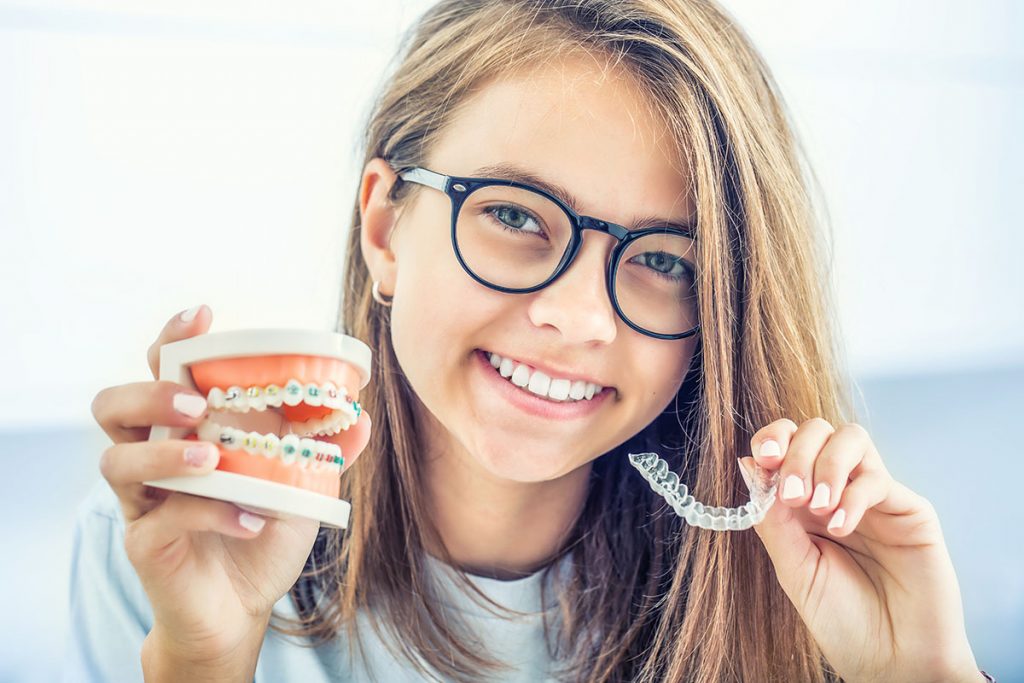 ¿Cuáles son las diferencias entre Invisalign y Brackets?