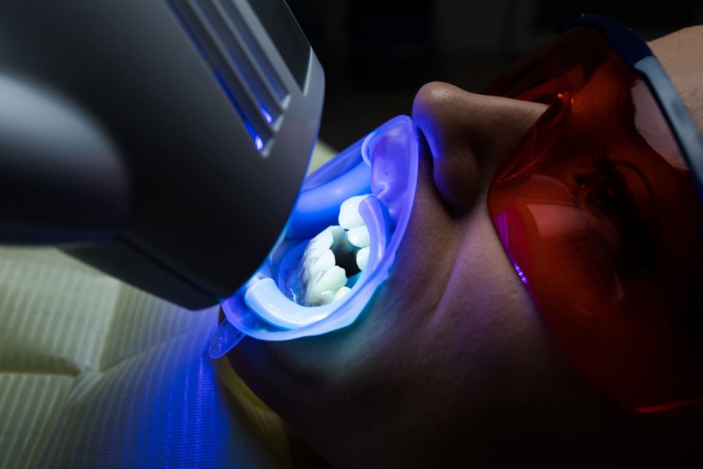 Teeth whitening with LED light in Panama