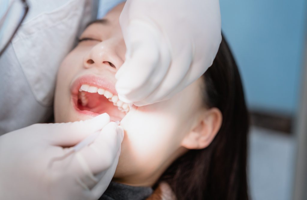 Wisdom tooth extraction with sedation in Panama