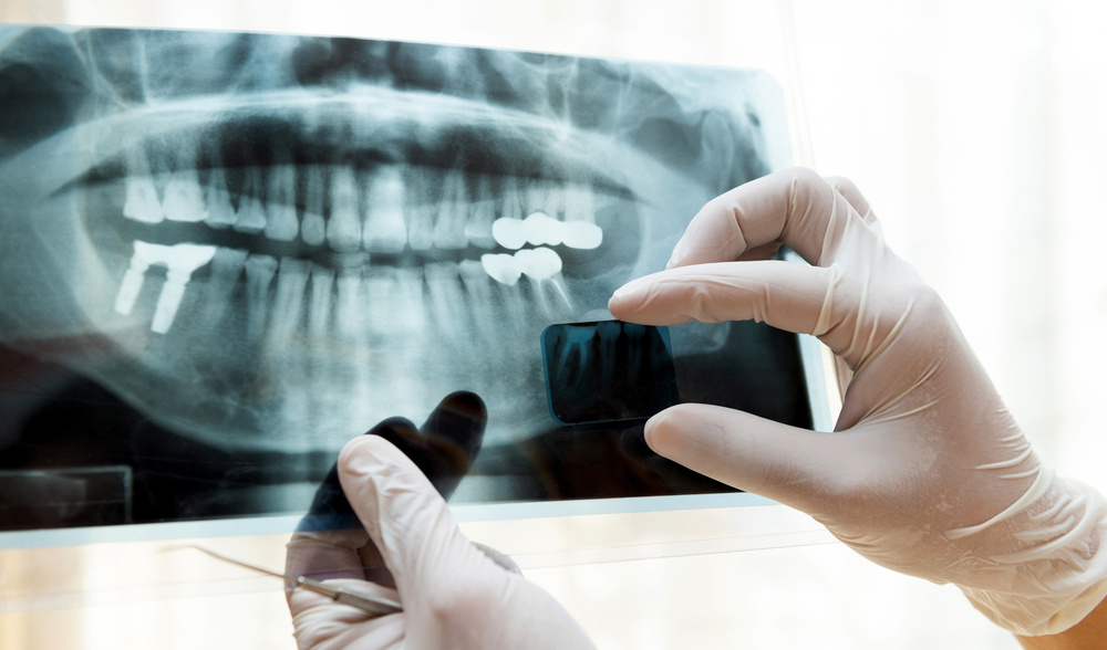 Digital Dental X-Ray In Panama