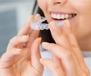 Tratamiento Invisalign En Panamá