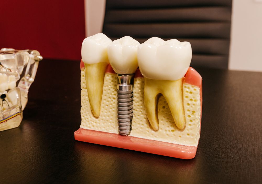 How does diabetes affect treatment with dental implants?