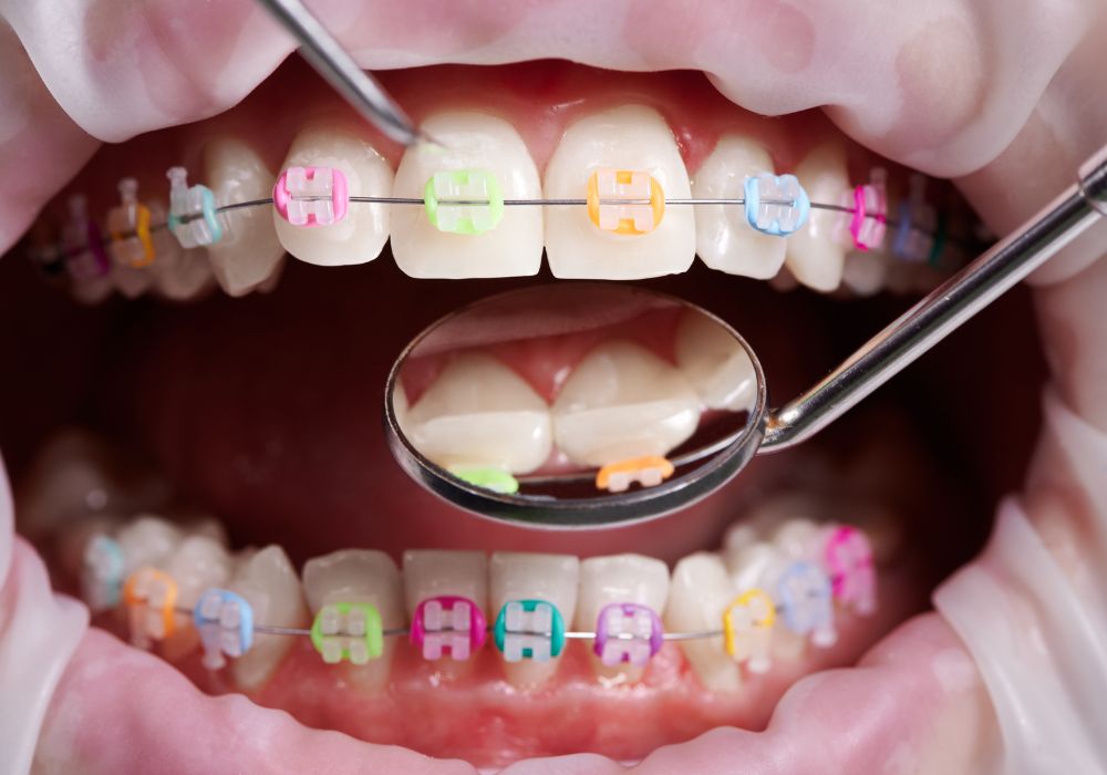 Orthodontic Specialists In Panama