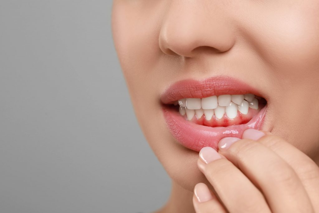 Consulta de periodoncia en Panama