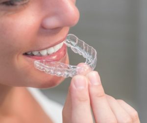 Invisible Braces in Panama: Everything You Need to Know