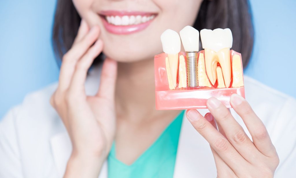 Is There an Alternative to Traditional Dental Implants in Panama?