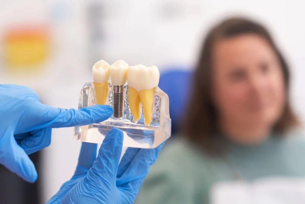 Diferencia entre puente e implante dental  Dental One